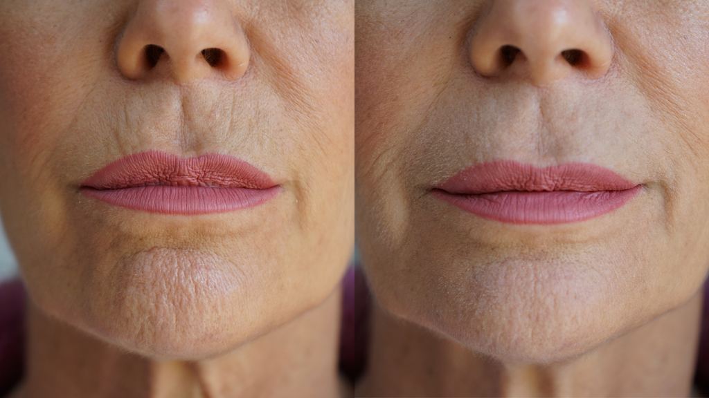 Ageless Lip & Line Filler — Instant Wrinkle Smoother for Lips, Lines & Pores