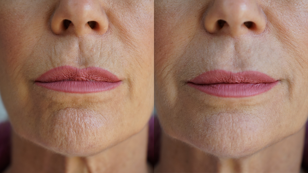 Ageless Lip & Line Filler — Instant Wrinkle Smoother for Lips, Lines & Pores