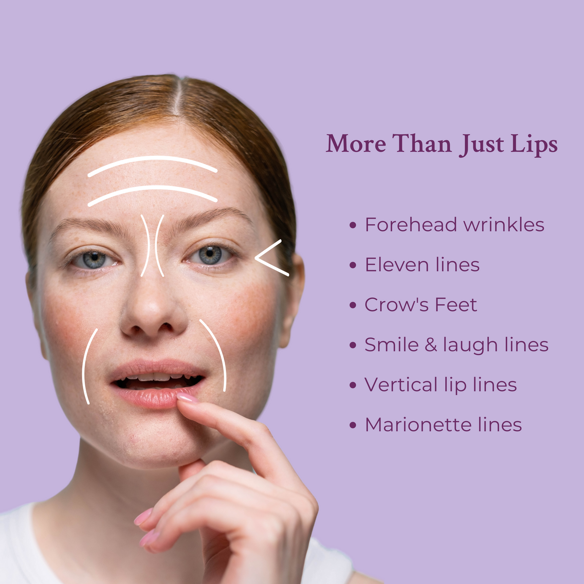 Ageless Lip & Line Filler — Instant Wrinkle Smoother for Lips, Lines & Pores
